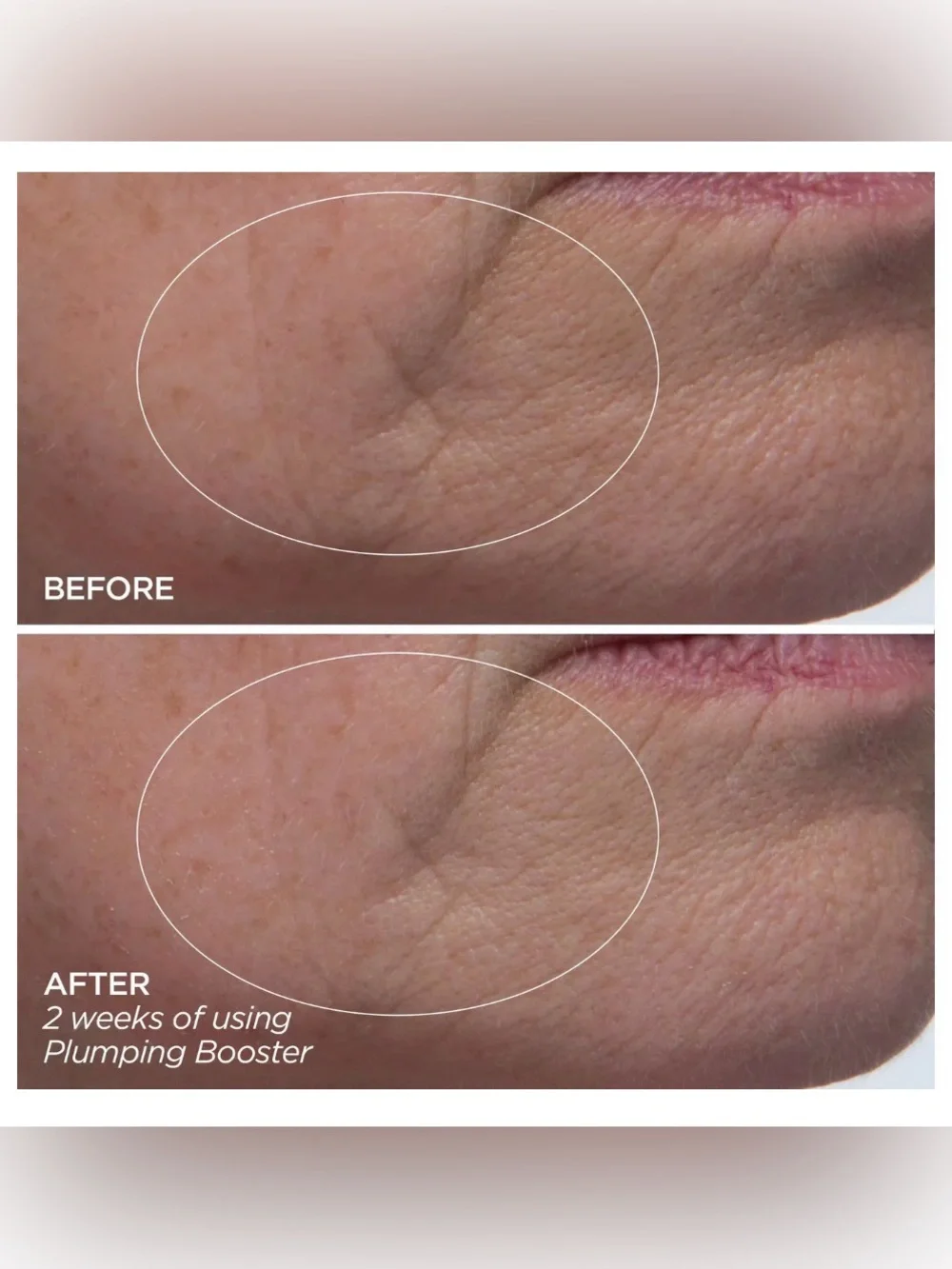 BEAUTYBIO Plumping Booster Hyaluronic Acid Supercharged Complex